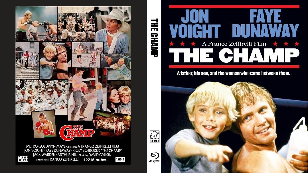 The Champ (1979) 1080P BLURAY CLASSIC