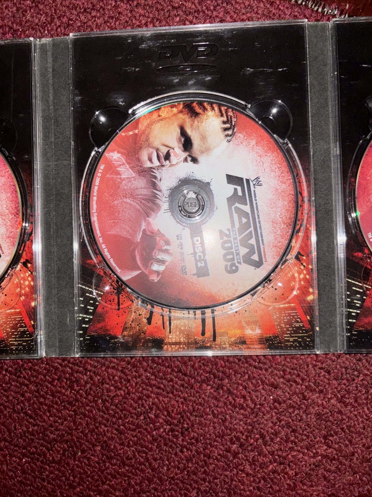 3 Disc Set DVD